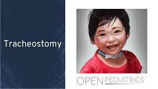 Thumbnail: Tracheostomy by R. Nuss, J. Perez, J. Laird-Gion | OPENPediatrics