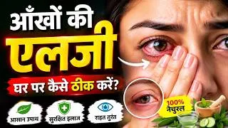Thumbnail: Eye Allergy Symptoms: आंखों की एलर्जी के लक्षण और बचाव के उपाय