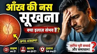 Thumbnail: आँख की नस सूखने के बाद क्या रोशनी वापस आ सकती हैं? #opticatrophy