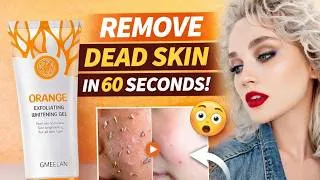 Thumbnail: Orange Exfoliating Gel Before & After Results