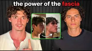 Thumbnail: How He Transformed His Recessed Jaw, Puffy Face, Pelvic Tilt, Smile, And Gut Health NATURALLY