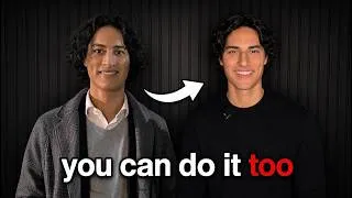 Thumbnail: How I Made My Smile More Attractive (without braces or aligners) | Full Guide