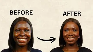 Thumbnail: SIMPLE EASY EVERYDAY MAKEUP TUTORIAL FOR BEGINNERS 