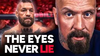 Thumbnail: 30 Million Reasons Conor McGregor Would Hide His Injury…