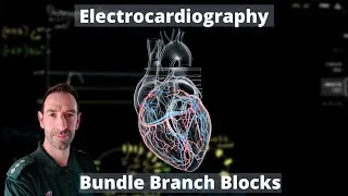 Thumbnail: ECG - Bundle Branch Blocks Explained