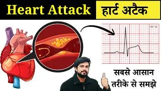Thumbnail: Heart Attack Kaise Hota Hai | Myocardial Infarction -  Types, Cause, Symptoms, Diagnosis, Treatment