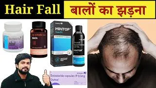 Thumbnail: बालों का झड़ना | Hair Loss || Types of Hair Fall || Alopecia Treatment | Hair Fall Solution Medicine