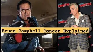 Thumbnail: Bruce Campbell Cancer EXPLAINED: Bruce Says He Has “5 Years” Left — What We Know About His Cancer