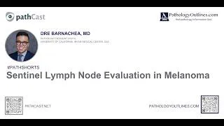Thumbnail: #PATHSHORTS  Sentinel Lymph Node Evaluation in Melanoma