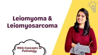 Thumbnail: Leiomyoma & Leiomyosarcoma - MCQ concepts