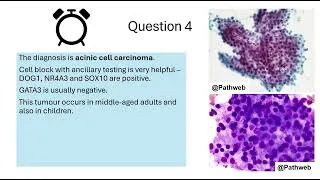 Thumbnail: Pathweb Cytopathology Quiz: Salivary Gland Cytology - Advanced/Hard level quiz 1