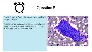 Thumbnail: Pathweb Cytology Quiz: Salivary Gland Cytology (Intermediate level Quiz 1)