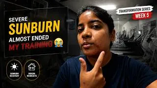 Thumbnail: Severe Sunburn Almost Ended My Training 😭 | Transformation Series Week 5