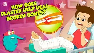 Thumbnail: Broken Bone Healing Process | How Plaster Helps in Fracture? | Bone Fractures | Dr. Binocs Show