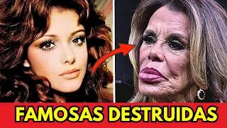 Thumbnail: 35 TERRIBLES Cirugías Plásticas de Famosos LATINOS