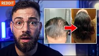 Thumbnail: He Almost Quit. 3 Years Later, This Happened