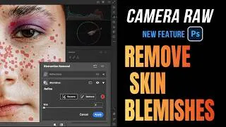 Thumbnail: Camera Raw 18.5 Gets a Powerful AI Skin Cleanup Tool