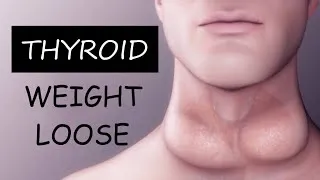 Thumbnail: Thyroid and Weight loose (HINDI) II Physiotherapy