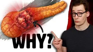 Thumbnail: Pancreatic Cancer Risk is High - Why?