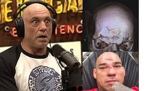 Thumbnail: Rogan on CRUSHED HEAD IN MMA