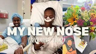 Thumbnail: I Had a Nose Job | Deviated Septum Surgery and Recovery Vlog