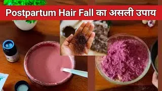 Thumbnail: How I Stopped Hair Fall After Pregnancy | beauty tips after pregnancy 😍