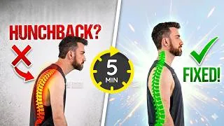 Thumbnail: Fix Hunchback Posture in 5-Min/Day (PostureFlow Routine)