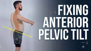Thumbnail: Why Core & Glute Exercises Aren't Fixing Your Anterior Pelvic Tilt Posture