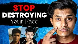 Thumbnail: 6  Biggest Skincare Mistakes Indians Are Making In 2025