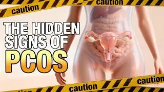 Thumbnail: Your PCOS May Be Hiding in These Symptoms