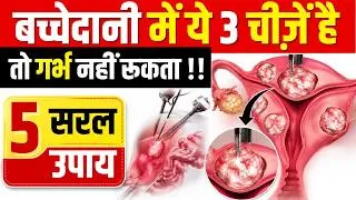 Thumbnail: बच्चेदानी में ये 3 चीजे है तो गर्भ नहीं रुकता ? Fibroid, Polyp Ya Cyst treatment tips
