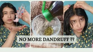 Thumbnail: I Tried This Hair Oiling Routine for Dandruff… Here’s What Happened! 😳✨ 