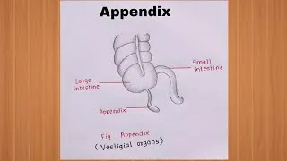 Thumbnail: How to Draw Appendix (Vestigial Organ) Diagram | How to Draw Appendix Diagram Easily