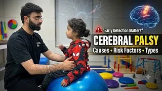 Thumbnail: CEREBRAL PALSY EXPLAINED SIMPLY | NEUROLOGY LECTURES | HINDI EXPLANATION | DR. AMAN KANDA (PT)