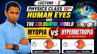 Thumbnail: Myopia vs Hypermetropia |Human Eye Chapter | Class 10 Physics | Full Concept | Lecture 2 #motivation