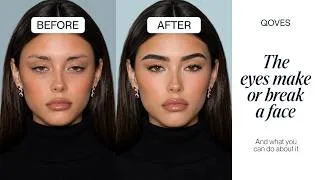 Thumbnail: Why the Eyes Make or Break a Face (And How to Fix Yours)