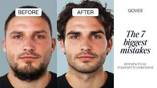 Thumbnail: 7 Mistakes Killing Your Attractiveness as a Man