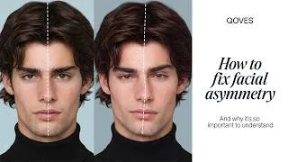 Thumbnail: Facial Asymmetry: How To Fix Your Uneven Face