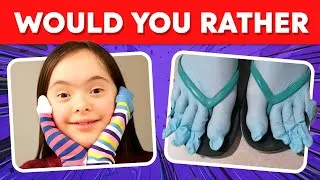 Thumbnail: Would You Rather - Hardest Choices Ever Part 2! 😱😨 Quiz Luna