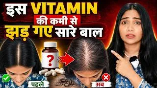 Thumbnail: 90% लोग नहीं जानते- Ek Vitamin से- झड़ रहे है आपके घने बाल, रुक गयी है Growth, ख़त्म हो रही है Density