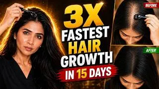 Thumbnail: पतले बालों को 15 Days में 3X मोटा और घना करने का Science- Dermarolling for 3X Faster Hair Regrowth