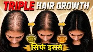 Thumbnail: 15 दिनों में 3X Hair Growth Activation Challenge-सिर्फ इन 5 चीज़ों से-Stop Thinning & Regrow 3X Hair