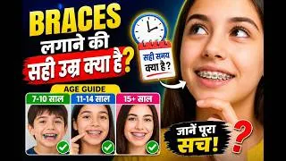 Thumbnail: टेढ़े-मेढ़े दांतों का इलाज करवाने की सही उम्र क्या है? बच्चों और बड़ों के लिए सही समय | Braces Time