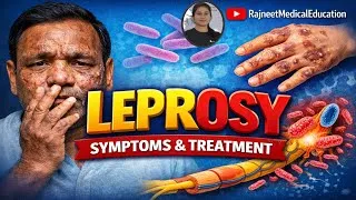 Thumbnail: Leprosy | Causative agent | Incubation period | Types | Sign & symptoms | Tests | Treatment