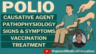 Thumbnail: Polio | Causes | Pathophysiology | Sign & Symptoms | Vaccination | Treatment