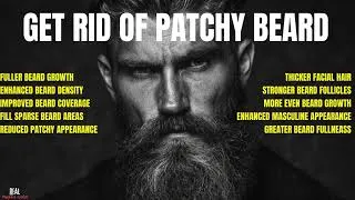 Thumbnail: Get rid of patchy beard (Morphic Field)