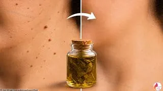 Thumbnail: This oil heals everything! 100,000 times more powerful! ☘️A true treasure from nature!