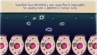 Thumbnail: Why diabetes occurs due to lack of this simple gut enzyme??