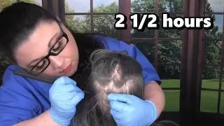 Thumbnail: ASMR Scalp Check and Treatment Compilation (Scalp Massage, Whispering)  Medical Roleplay
