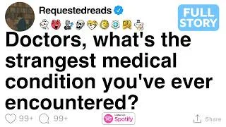Thumbnail: [FULL STORY] Doctors, what's the strangest medical condition you've ever encountered?